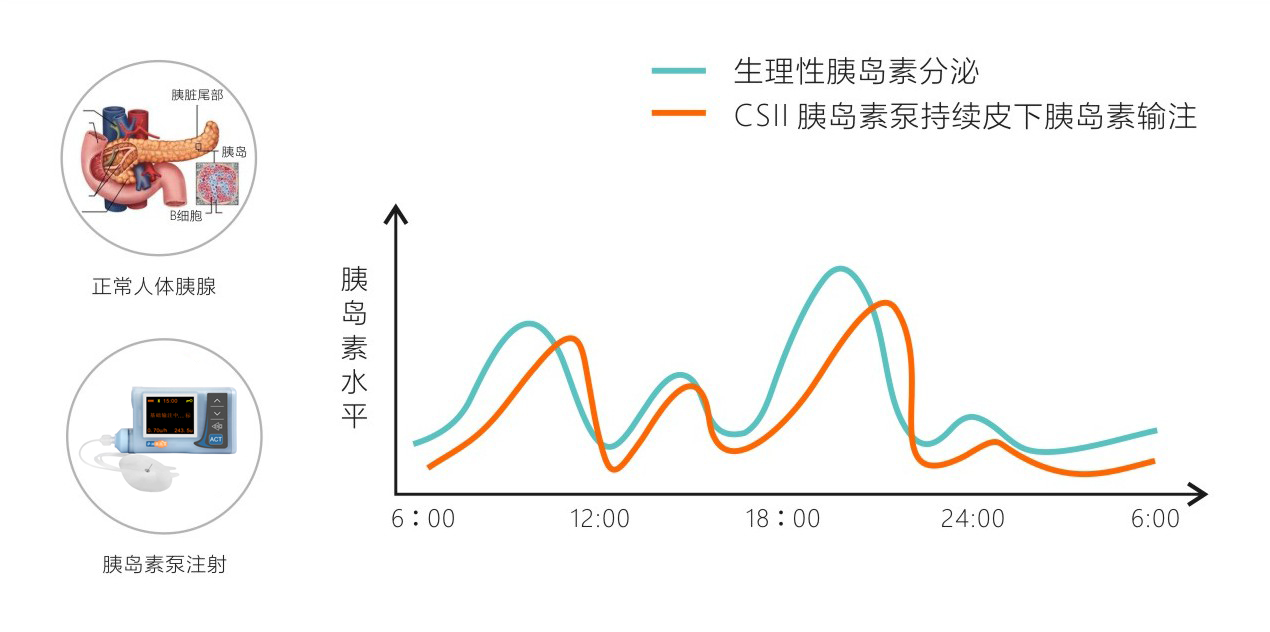 输注对比图.jpg