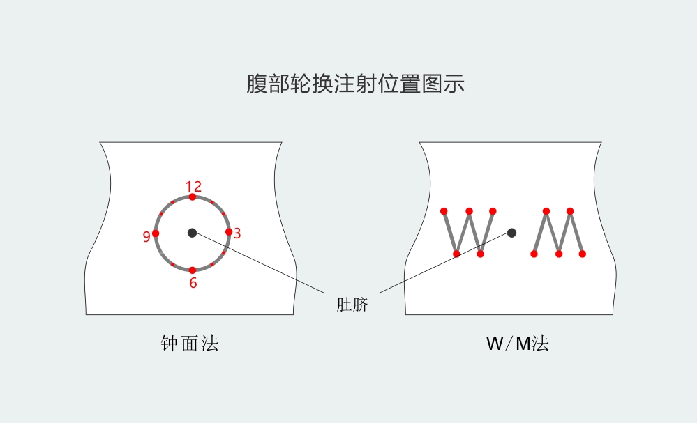 腹部轮换注射图示.jpg